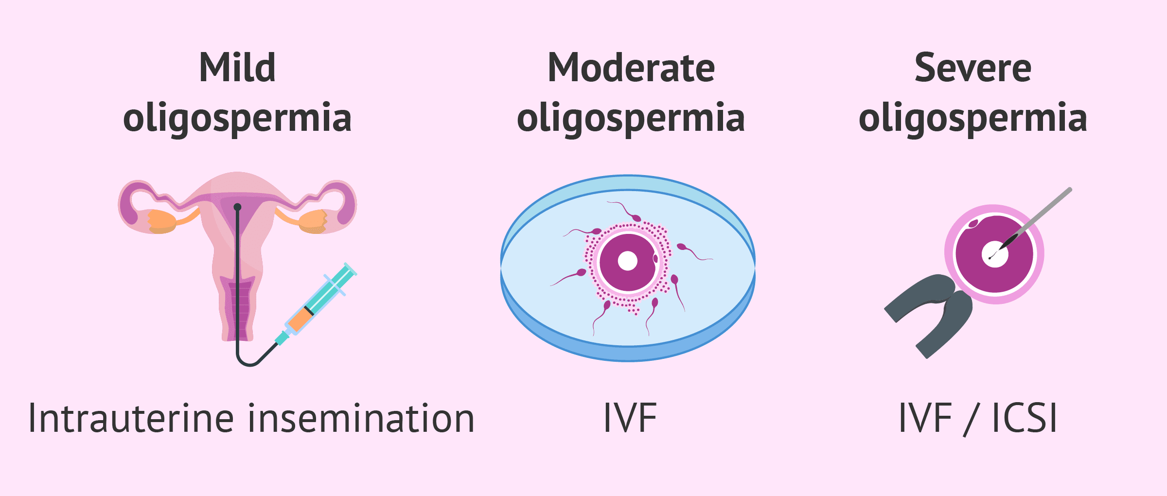 Moderate Oligospermia and Treatment of Oligospermia